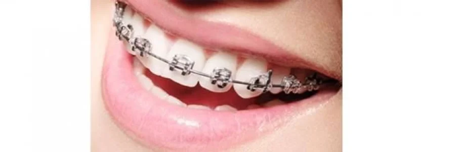 Clínica de Ortodôntia Estética em São Gonçalo