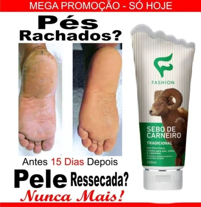 Creme para Os Pés, Mãos Cotovelos c/ Sebo Carneiro Uréia Cacau Diabetes e Pele Ressecada