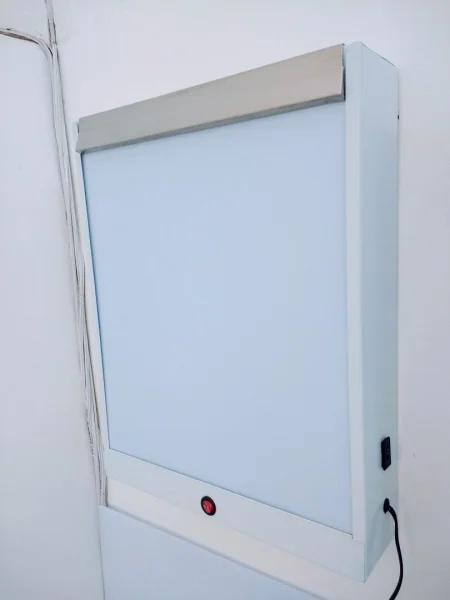 Negatoscópio 01 Corpo para Raio X Led( Pronta Entrega)