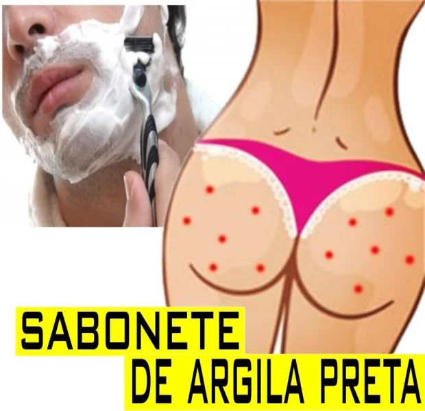 Sabonete de Argila p/ pelo Encravado, Bolinha no Bumbum, Barba, Virilha