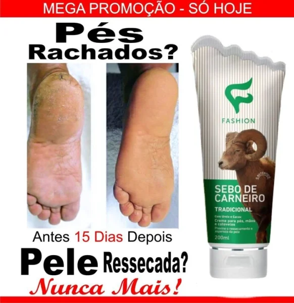 Creme para Os Pés, Mãos Cotovelos c/ Sebo Carneiro Uréia Cacau Diabetes e Pele Ressecada